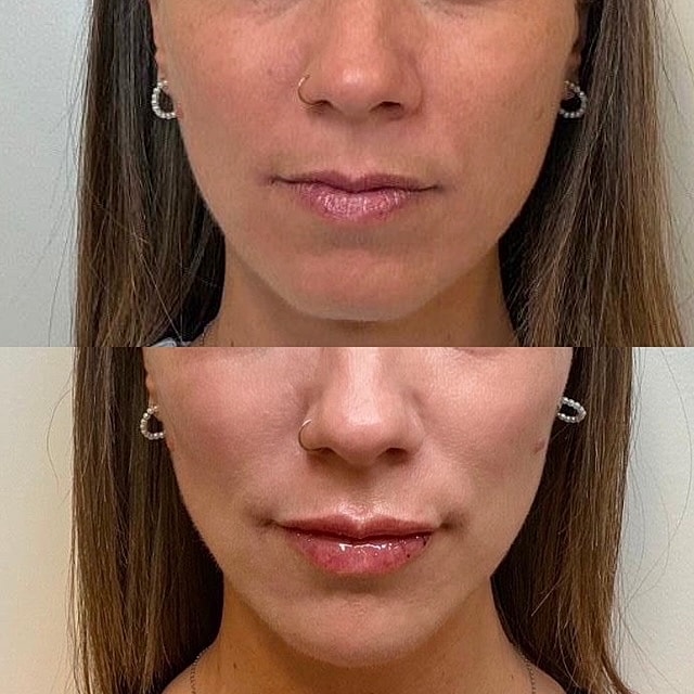 Facial Balancing
